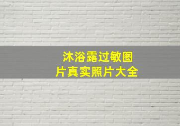 沐浴露过敏图片真实照片大全